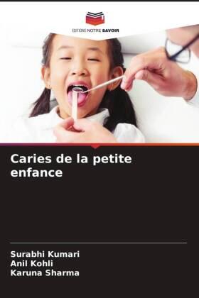 Kumari / Kohli / Sharma |  Caries de la petite enfance | Buch |  Sack Fachmedien