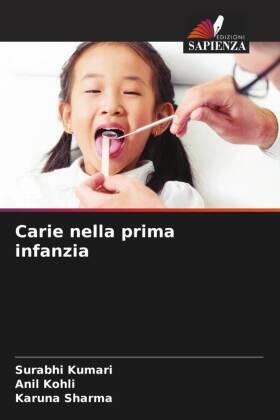 Kumari / Kohli / Sharma |  Carie nella prima infanzia | Buch |  Sack Fachmedien