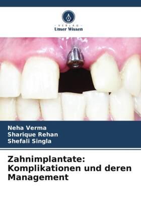 Verma / Rehan / Singla |  Zahnimplantate: Komplikationen und deren Management | Buch |  Sack Fachmedien