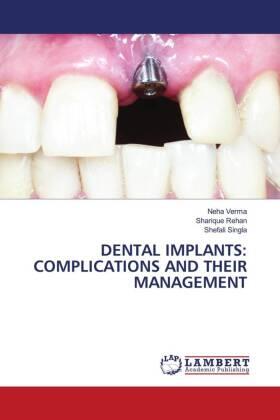 Verma / Rehan / Singla |  DENTAL IMPLANTS: COMPLICATIONS AND THEIR MANAGEMENT | Buch |  Sack Fachmedien