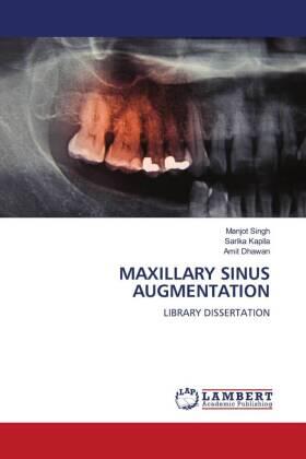 Singh / Kapila / Dhawan |  MAXILLARY SINUS AUGMENTATION | Buch |  Sack Fachmedien