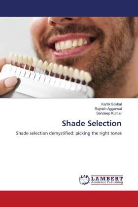 Sokhal / Aggarwal / Kumar |  Shade Selection | Buch |  Sack Fachmedien