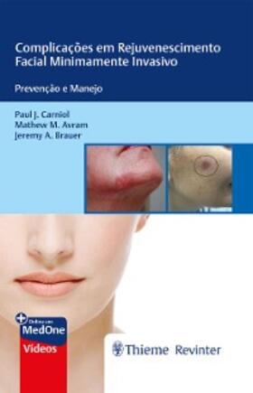 Carniol / Avram / Brauer |  Complicações em Rejuvenescimento Facial Minimamente Invasivo | eBook | Sack Fachmedien