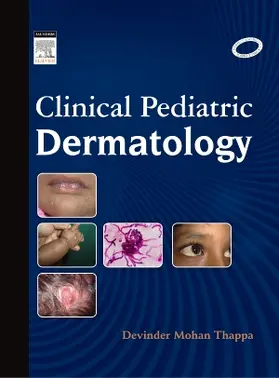  Clinical Pediatric Dermatology | Buch |  Sack Fachmedien