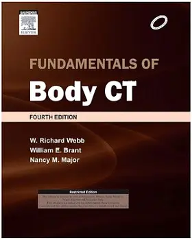 Webb / Brant / Major |  Fundamentals of Body CT | Buch |  Sack Fachmedien