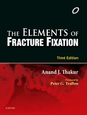 Thakur |  Elements of Fracture Fixation | Buch |  Sack Fachmedien