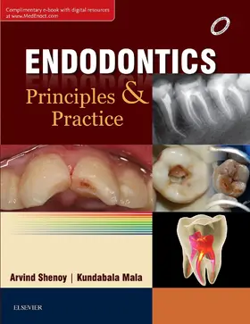 Shenoy / MALA |  Endodontics: Principles and Practice E-book | eBook | Sack Fachmedien