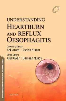 Nundy M. Chir / Nundy |  Understanding Heartburn and Reflux Oesophagitis - e-Book | eBook | Sack Fachmedien