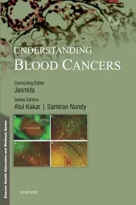 Nundy |  Understanding Blood Cancers | Buch |  Sack Fachmedien