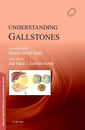 Kakar / Nundy |  Understanding Gallstones - E-Book | eBook | Sack Fachmedien