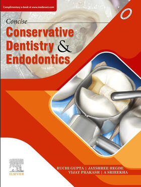 Gupta / Hegde / Prakash |  Concise Conservative Dentistry and Endodontics- E Book | eBook | Sack Fachmedien
