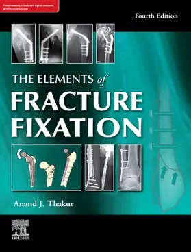 Thakur |  The elements of fracture fixation, 4e | Buch |  Sack Fachmedien