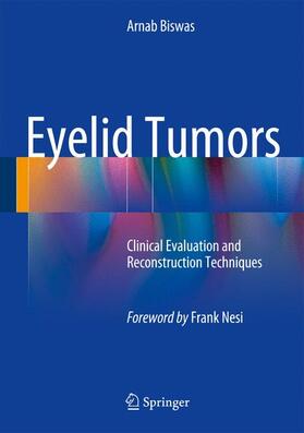 Biswas |  Eyelid Tumors | Buch |  Sack Fachmedien