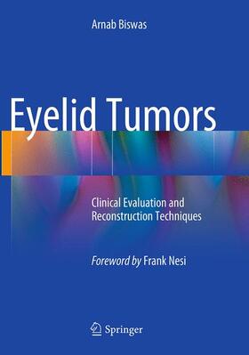 Biswas |  Eyelid Tumors | Buch |  Sack Fachmedien