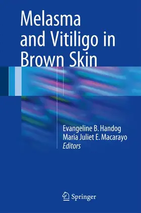 Enriquez-Macarayo / Handog |  Melasma and Vitiligo in Brown Skin | Buch |  Sack Fachmedien