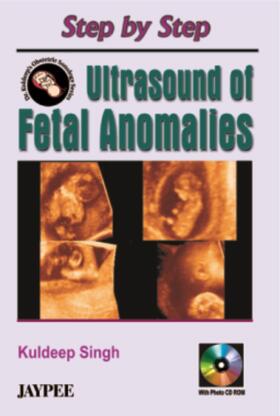 Singh |  Step by Step Ultrasound of Fetal Anomalies | Buch |  Sack Fachmedien