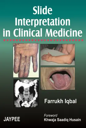 Iqbal |  Slide Interpretation in Clinical Medicine | Buch |  Sack Fachmedien