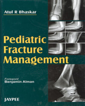 Bhaskar |  Pediatric Fracture Management | Buch |  Sack Fachmedien