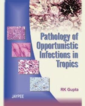 Gupta |  Pathology of Opportunistic Infections in Tropics | Buch |  Sack Fachmedien