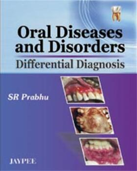 Prabhu |  Prabhu, S: Oral Diseases and Disorders | Buch |  Sack Fachmedien