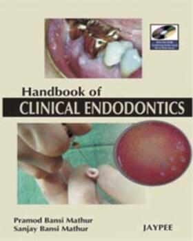 Mathur |  Mathur, P: A Hand Book of Clinical Endodontics | Buch |  Sack Fachmedien