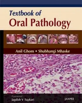 Ghom / Mhaske |  Textbook of Oral Pathology | Buch |  Sack Fachmedien