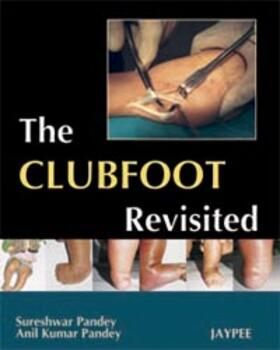 Pandey |  Pandey, S: The Club Foot Revisited | Buch |  Sack Fachmedien