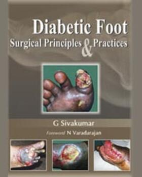 Sivakumar |  Diabetic Foot | Buch |  Sack Fachmedien