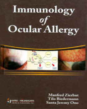 Zierhut / Biedermann / Ono |  Immunology of Ocular Allergy | Buch |  Sack Fachmedien