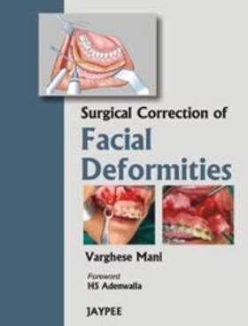 Mani |  Mani, V: Surgical Correction of Facial Deformities | Buch |  Sack Fachmedien