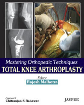 Malhotra |  Mastering Orthopedic Techniques: Total Knee Arthroplasty | Buch |  Sack Fachmedien