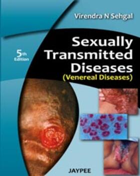 Sehgal |  Sehgal, V: Sexually Transmitted Diseases (Venereal Diseases) | Buch |  Sack Fachmedien