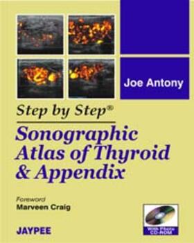 Antony |  Antony, J: Step by Step: Sonographic Atlas of Thyroid and Ap | Buch |  Sack Fachmedien