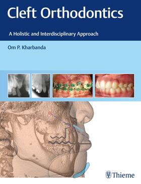 Kharbanda |  Cleft Orthodontics | Buch |  Sack Fachmedien