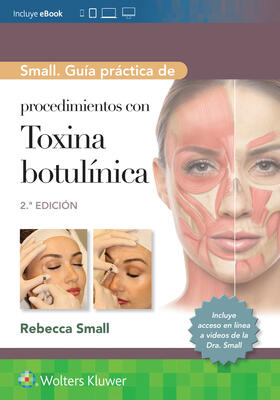 Small |  Small. Guia practica de procedimientos con toxina botulinica | Buch |  Sack Fachmedien