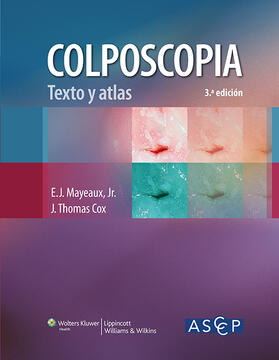 American Society for Colposcopy and Cervical Pathology / Mayeaux / Cox |  Colposcopia. Texto y atlas | Buch |  Sack Fachmedien