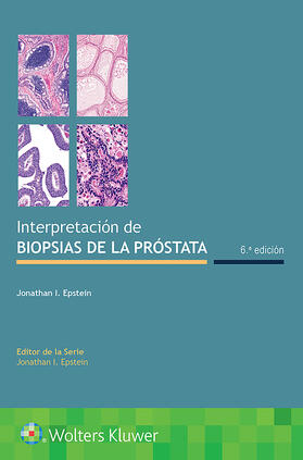 Epstein |  Interpretación de biopsias de la próstata (6ª edición) | Buch |  Sack Fachmedien