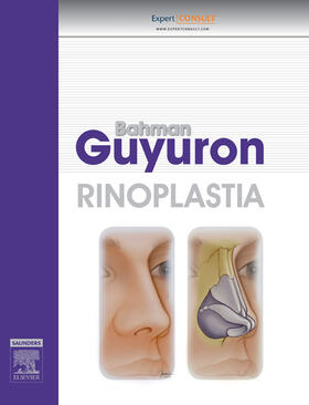 Guyuron |  Rinoplastia | eBook | Sack Fachmedien