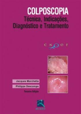 Marchetta / Descamps |  Colposcopia | eBook | Sack Fachmedien