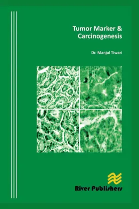 Tiwari |  Tumor Marker and Carcinogenesis | Buch |  Sack Fachmedien