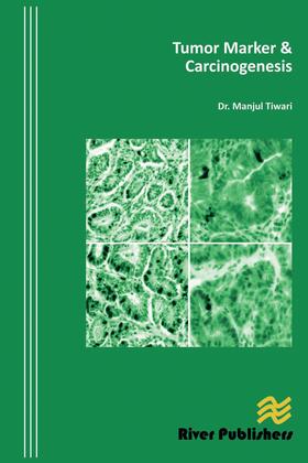 Tiwari |  Tumor Marker & Carcinogenesis | Buch |  Sack Fachmedien