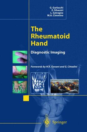 Garlaschi / Silvestri / Satragno |  The Rheumatoid Hand | Buch |  Sack Fachmedien