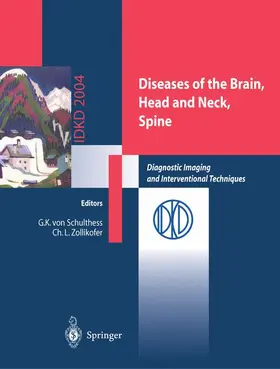 Zollikofer / Schulthess |  Diseases of the Brain, Head and Neck, Spine | Buch |  Sack Fachmedien