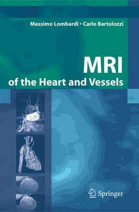 Lombardi / Bartolozzi |  MRI of the Heart and Vessels | Buch |  Sack Fachmedien