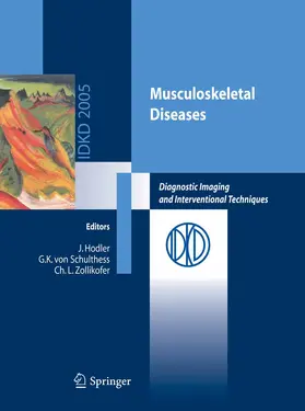 Schulthess / Zollikofer |  Musculoskeletal Diseases | eBook | Sack Fachmedien