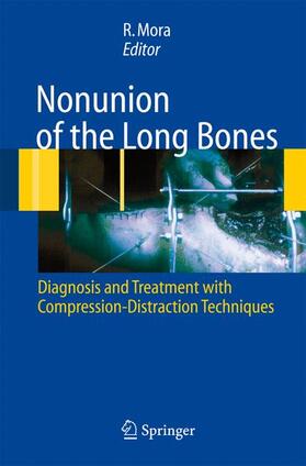 Mora |  Nonunion of the Long Bones | Buch |  Sack Fachmedien