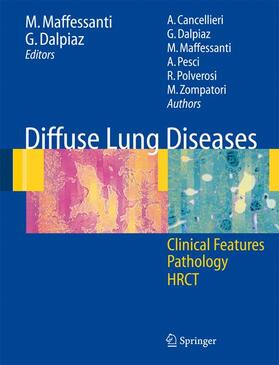 Maffessanti / Dalpiaz |  Diffuse Lung Diseases | Buch |  Sack Fachmedien