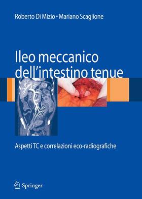 Di Mizio / Mizio / Scaglione |  Ileo meccanico dell'intestino tenue | eBook | Sack Fachmedien