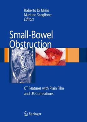 Di Mizio / Scaglione |  Small-Bowel Obstruction | Buch |  Sack Fachmedien