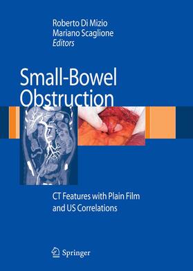 Di Mizio / Mizio / Scaglione |  Small-Bowel Obstruction | eBook | Sack Fachmedien